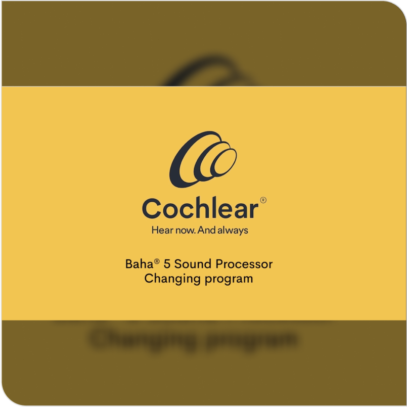 Cochlear